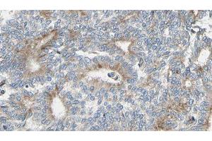 ABIN6275363 at 1/100 staining Human prostate tissue by IHC-P. (Plakophilin 4 Antikörper  (N-Term))