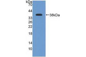 Figure. (ATR Antikörper  (AA 2353-2644))