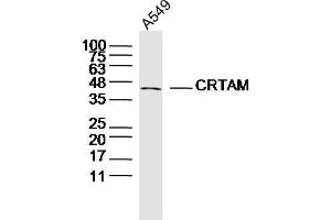 Human A549 cells probed with CRTAM Polyclonal Antibody, unconjugated  at 1:300 overnight at 4°C followed by a conjugated secondary antibody at 1:10000 for 90 minutes at 37°C. (CRTAM Antikörper  (AA 31-130))