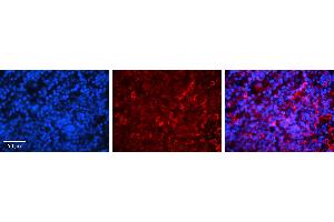 Rabbit Anti-IRF3 Antibody   Formalin Fixed Paraffin Embedded Tissue: Human Lymph Node Tissue Observed Staining: Cytoplasm Primary Antibody Concentration: 1:100 Other Working Concentrations: 1:600 Secondary Antibody: Donkey anti-Rabbit-Cy3 Secondary Antibody Concentration: 1:200 Magnification: 20X Exposure Time: 0. (IRF3 Antikörper  (C-Term))