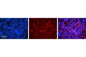 Rabbit Anti-IRF3 Antibody   Formalin Fixed Paraffin Embedded Tissue: Human Lymph Node Tissue Observed Staining: Cytoplasm Primary Antibody Concentration: 1:100 Other Working Concentrations: 1:600 Secondary Antibody: Donkey anti-Rabbit-Cy3 Secondary Antibody Concentration: 1:200 Magnification: 20X Exposure Time: 0. (IRF3 Antikörper  (C-Term))