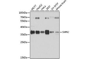 Western blot analysis of extracts of various cell lines, using SMN2 antibody. (SMN2 Antikörper)