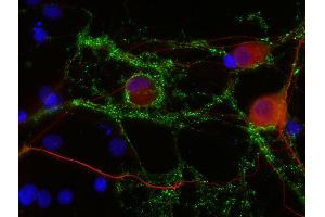 Indirect immunostaining of PFA fixed rat hippocampus neurons with anti-Neurofilament L (dilution 1 : 500; red) and mouse anti-Synapsin 1 (, dilution 1 : 1000; green). (NEFL Antikörper  (AA 1-284))