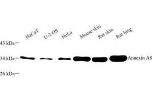 Western blot analysis of Annexin-A8 (ABIN7073071) at dilution of 1: 500 (Annexin VIII Antikörper)