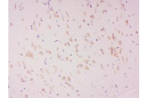 Formalin-fixed and paraffin embedded rat brain labeled with Anti-LATS2 (Ser83) Polyclonal Antibody, Unconjugated  at 1:300 followed by conjugation to the secondary antibody and DAB staining. (LATS2 Antikörper  (pSer83))