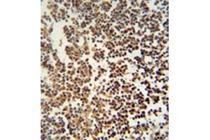 Immunohistochemistry analysis in formalin fixed and paraffin embedded human lymph tissue reacted with GTSF1 Antibody (Center) Cat. (GTSF1 Antikörper  (Middle Region))