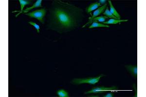 Immunofluorescence of purified MaxPab antibody to MAPKAPK2 on HeLa cell. (MAPKAP Kinase 2 Antikörper  (AA 1-400))