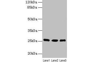Western blot All lanes: LIN7A antibody at 6 μg/mL Lane 1: Human placenta tissue Lane 2: Mouse kidney tissue Lane 3: Mouse liver tissue Secondary Goat polyclonal to rabbit IgG at 1/10000 dilution Predicted band size: 26 kDa Observed band size: 26 kDa (LIN7A Antikörper  (AA 1-233))