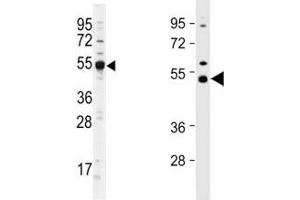 Western blot analysis of Dnmt2 antibody and mouse cerebellum lysate. (Dnmt2 Antikörper  (AA 346-375))