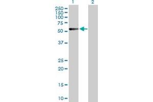 Western Blot analysis of CALCR expression in transfected 293T cell line by CALCR MaxPab polyclonal antibody.