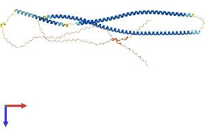 Keratin 86 Protein (KRT86) (AA 1-486) (His tag)
