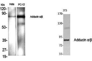 Western Blot (WB) analysis of specific cells using Adducin alpha/beta Polyclonal Antibody. (Adducin alpha/beta (Lys5) Antikörper)