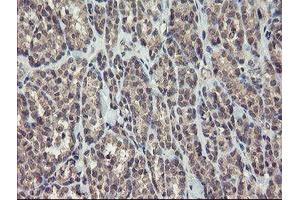 Image no. 4 for anti-rho GTPase Activating Protein 2 (ARHGAP2) antibody (ABIN1499627)