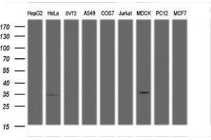 Image no. 2 for anti-Low Density Lipoprotein Receptor Adaptor Protein 1 (LDLRAP1) antibody (ABIN1496693) (LDLRAP1 Antikörper)
