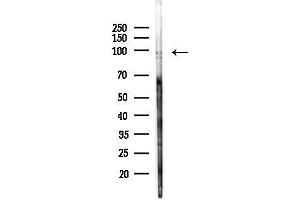 anti-phosphorylase, Glycogen, Brain (GPBB) (C-Term) antibody