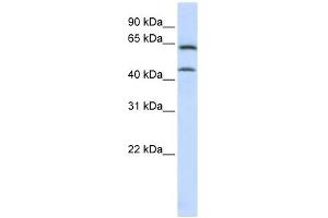 CHGN antibody used at 1 ug/ml to detect target protein. (CSGALNACT1 Antikörper  (C-Term))