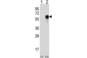 Western Blotting (WB) image for anti-Oncoprotein Induced Transcript 3 (OIT3) antibody (ABIN2996200)
