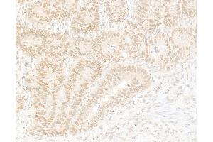 Immunohistochemistry (IHC) image for anti-K(lysine) Acetyltransferase 8 (KAT8) (AA 1-50) antibody (ABIN7454709)