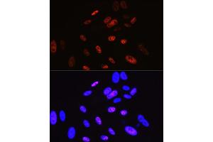 Immunofluorescence analysis of U-2 OS cells using Cyclin H Rabbit mAb (ABIN7266569) at dilution of 1:100 (40x lens). (Cyclin H Antikörper)