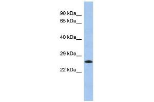 MGC50273 antibody used at 1 ug/ml to detect target protein. (MGC50273 (N-Term) Antikörper)
