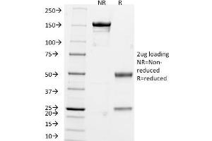 SDS-PAGE Analysis of Purified Chromogranin A Monoclonal Antibody (CHGA/765). (Chromogranin A Antikörper)