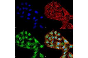 Immunocytochemistry/Immunofluorescence analysis using Rabbit Anti-WIPI2 Polyclonal Antibody . (WIPI2 Antikörper  (C-Term) (Atto 594))