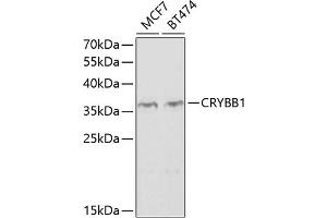 Western blot analysis of extracts of various cell lines, using CRYBB1 antibody  at 1:1000 dilution. (CRYBB1 Antikörper  (AA 1-252))