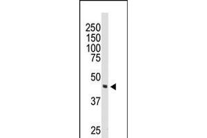 Western blot analysis of anti-DOK2 Pab in 174xCEM cell lysate (DOK2 Antikörper  (C-Term))