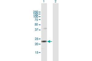 Western Blot analysis of SNX12 expression in transfected 293T cell line by SNX12 MaxPab polyclonal antibody. (SNX12 Antikörper  (AA 1-172))