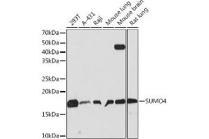 SUMO4 anticorps