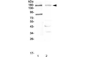 Western Blotting (WB) image for anti-Niemann-Pick Disease, Type C1 (NPC1) (AA 1022-1278) antibody (ABIN5708097)