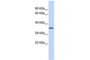 Image no. 1 for anti-Zinc Finger Protein 124 (ZNF124) (C-Term) antibody (ABIN6740539)