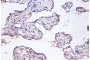 Immunohistochemistry of paraffin-embedded human placenta tissue using ABIN7148312 at dilution of 1:100 (COMMD4 Antikörper  (AA 1-195))