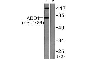 Western blot analysis of extracts from Hela cells treated with Forskolin (40nM, 30mins), using ADD1 (phospho-Ser726) antibody (#A0002). (alpha Adducin Antikörper  (pSer726))
