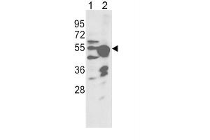 Western Blotting (WB) image for anti-Cytochrome P450, Family 2, Subfamily R, Polypeptide 1 (CYP2R1) antibody (ABIN3003559) (CYP2R1 Antikörper)