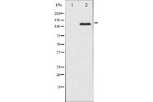 Western blot analysis of c-Kit expression in HeLa whole cell lysates,The lane on the left is treated with the antigen-specific peptide. (KIT Antikörper  (Internal Region))