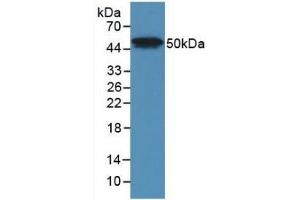 Detection of Recombinant LpPLA2, Human using Monoclonal Antibody to Phospholipase A2 Group VII (LpPLA2) (PLA2G7 Antikörper  (AA 22-441))