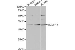 Western blot analysis of extracts of various cell lines, using ACVR1B antibody (ABIN5973168) at 1/1000 dilution. (Activin A Receptor Type IB/ALK-4 Antikörper)