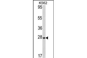 Western blot analysis of hARL1-G3 (ABIN388997 and ABIN2839227) in K562 cell line lysates (35 μg/lane). (ARL1 Antikörper  (N-Term))