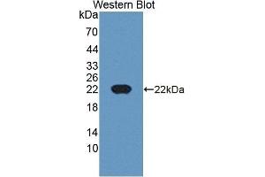 Detection of Recombinant CDKN2D, Human using Polyclonal Antibody to Cyclin Dependent Kinase Inhibitor 2D (CDKN2D) (CDKN2D Antikörper  (AA 1-166))