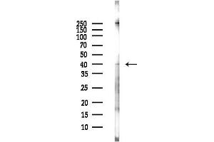 Western blot analysis of lysates from EC304 cells(LPS, 4h treatment), using MCUR1 Antibody at 1/1000 dilution.