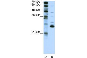 WB Suggested Anti-RCV1 Antibody Titration:  0. (Recoverin Antikörper  (C-Term))