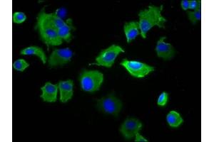 Immunofluorescence staining of MCF-7 cells with ABIN7169703 at 1:133, counter-stained with DAPI. (SIRPB1 Antikörper  (Isoform 3))