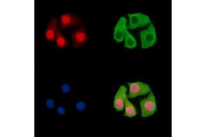 ABIN7096468 and ABIN7100532 staining Hela cells by IF/ICC. (Znf423 Antikörper)
