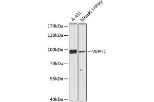 Western blot analysis of extracts of various cell lines, using VEPH1 Antibody (ABIN7271308) at 1:1000 dilution. (VEPH1 Antikörper  (AA 448-547))