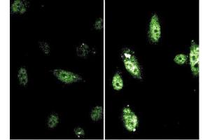 Immunofluorescence (IF) image for anti-Signal Transducer and Activator of Transcription 6, Interleukin-4 Induced (STAT6) (pTyr641) antibody (ABIN968594)