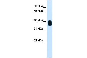WB Suggested Anti-ETV7 Antibody Titration:  0. (ETV7 Antikörper  (C-Term))