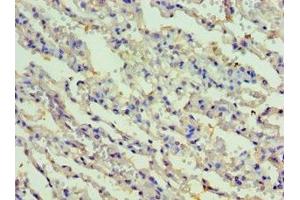 Immunohistochemistry of paraffin-embedded human lung tissue using ABIN7167479 at dilution of 1:100 (RIPK3 Antikörper  (AA 1-120))