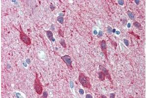 Immunohistochemistry (Formalin-fixed Paraffin-embedded Sections) (IHC (fp)) image for anti-Potassium Voltage-Gated Channel, Shaw-Related Subfamily, Member 2 (KCNC2) (AA 589-638) antibody (ABIN2878798)