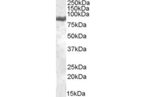 Image no. 1 for anti-Lactotransferrin (LTF) (Internal Region) antibody (ABIN375038) (Lactoferrin Antikörper  (Internal Region))